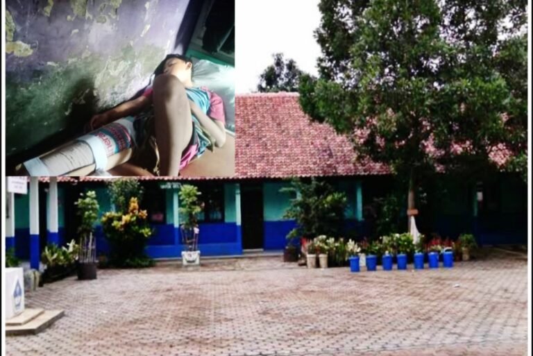 Siswa SMP di Karawang Patah Kaki Tertimpa Plafon Sekolah, Orang Tua Keluhkan Tanggung Jawab Dibatasi 20 Hari